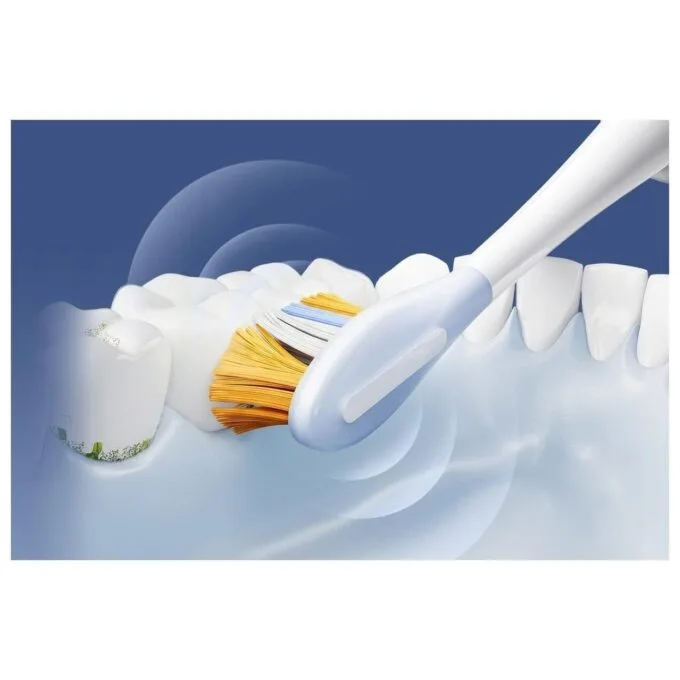Dreame F02 Pro Set blue — image 5